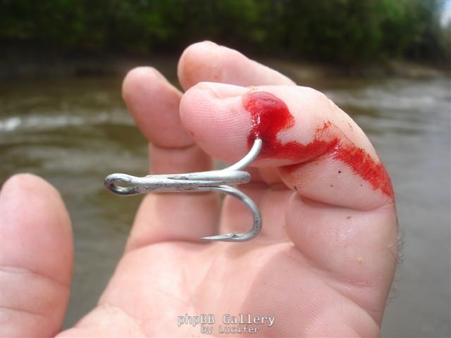 hook in my finger